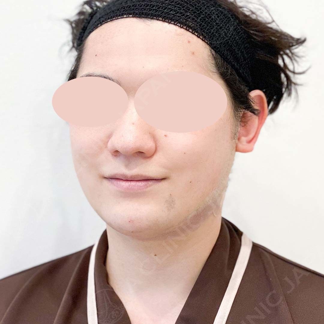 AFTER