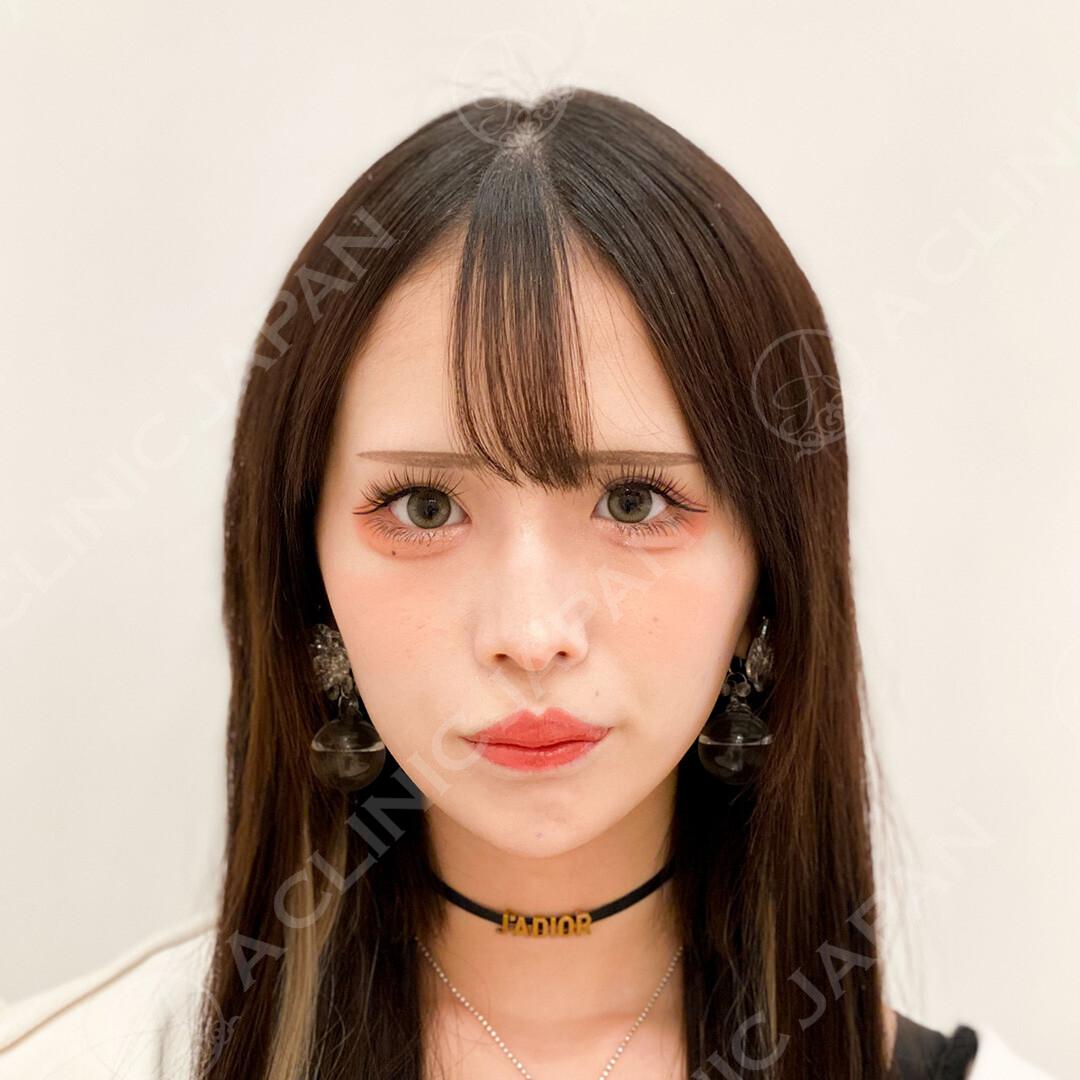 AFTER