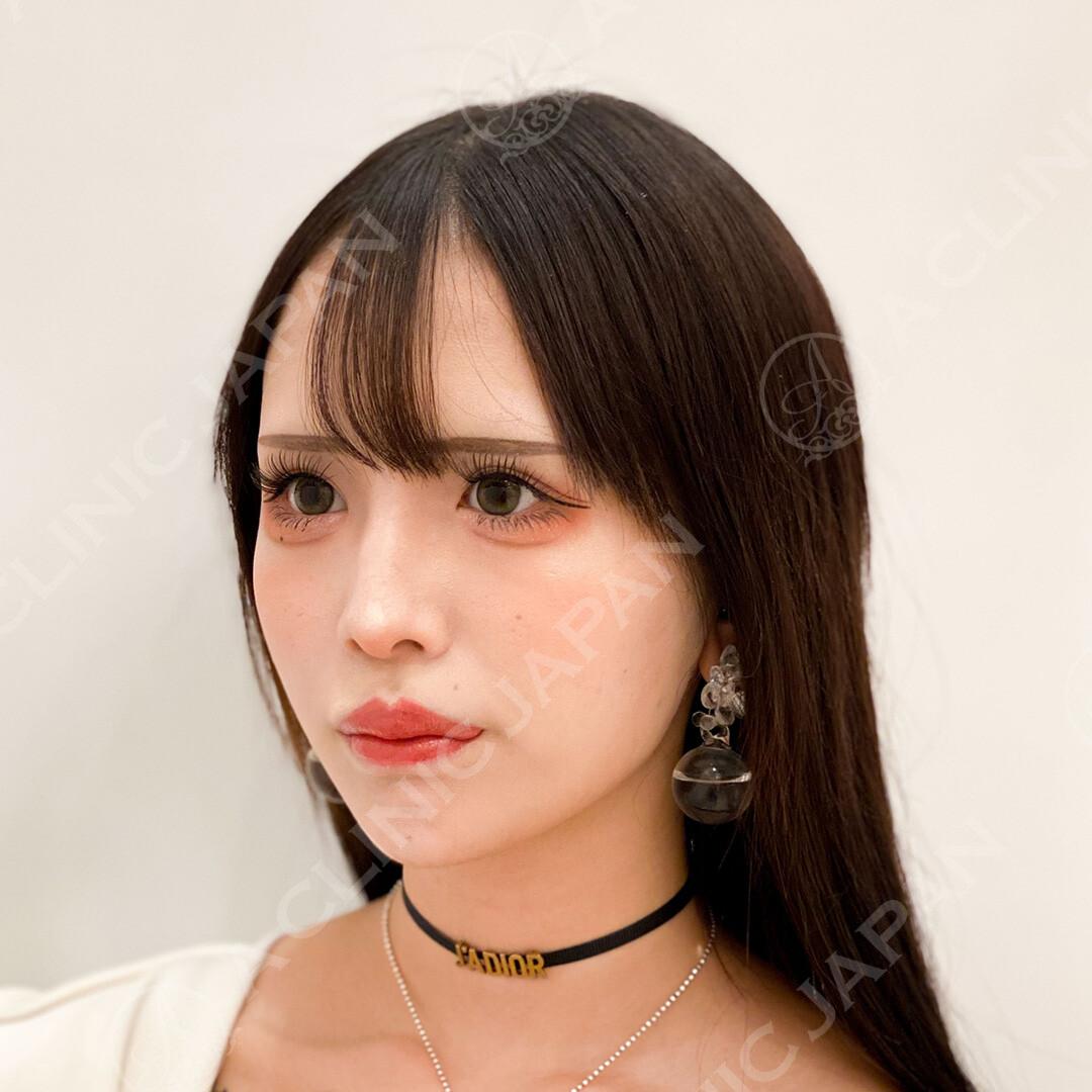 AFTER