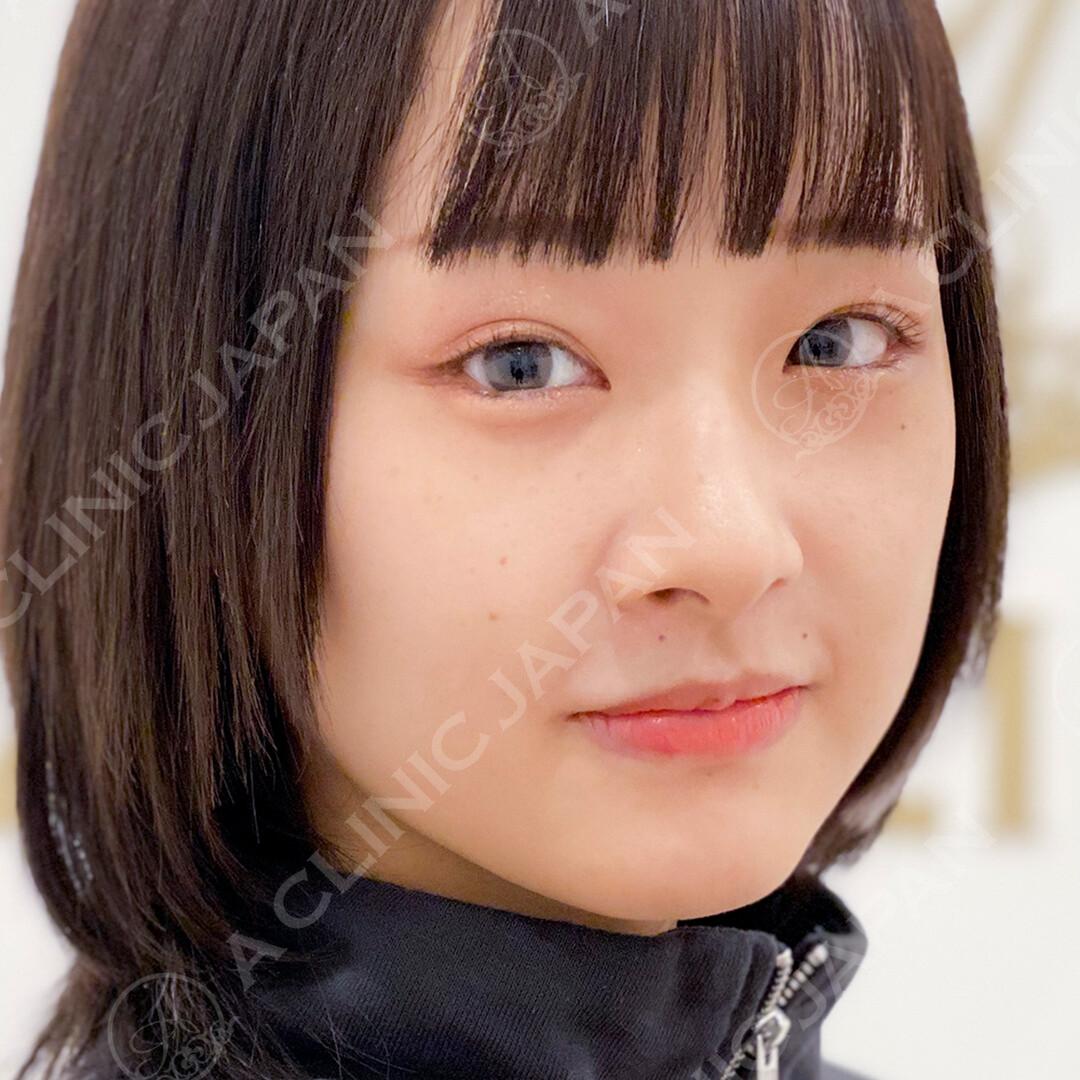 AFTER