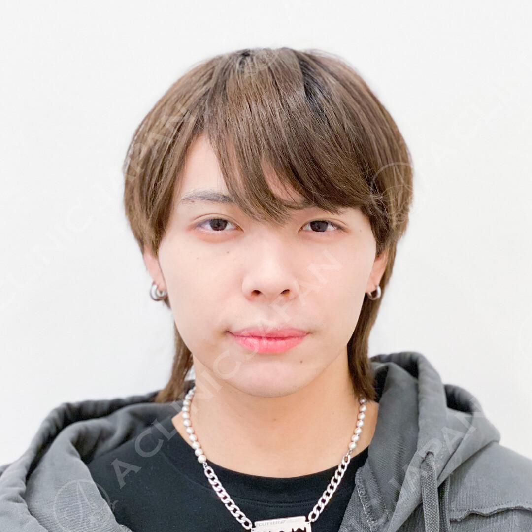 AFTER