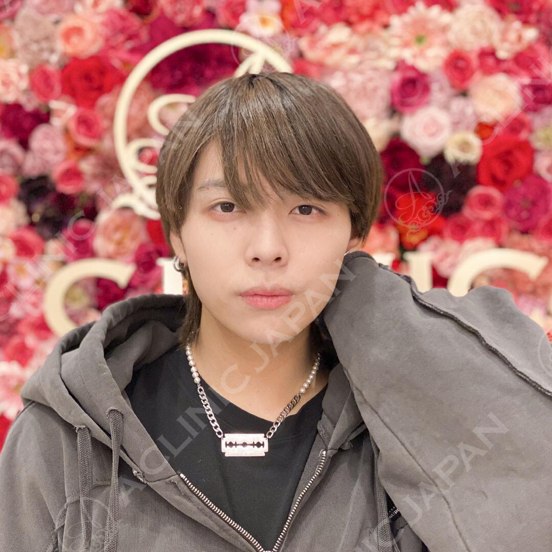 AFTER