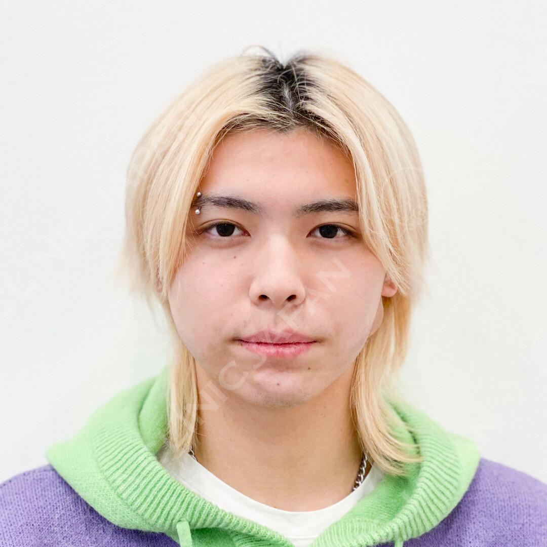 AFTER