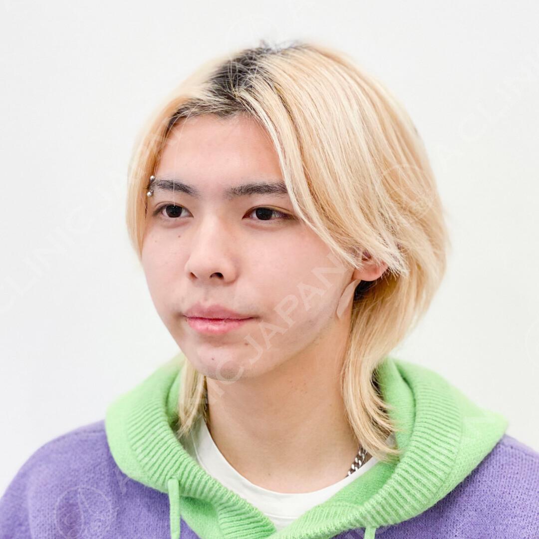 AFTER