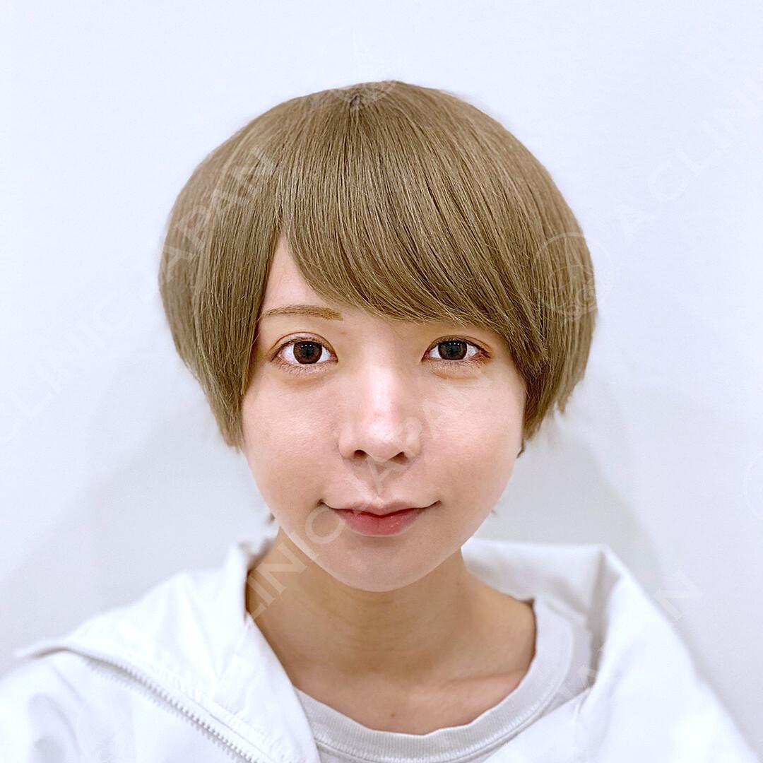 AFTER