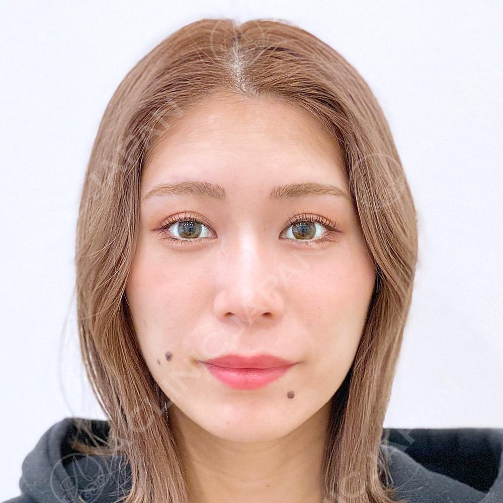 AFTER