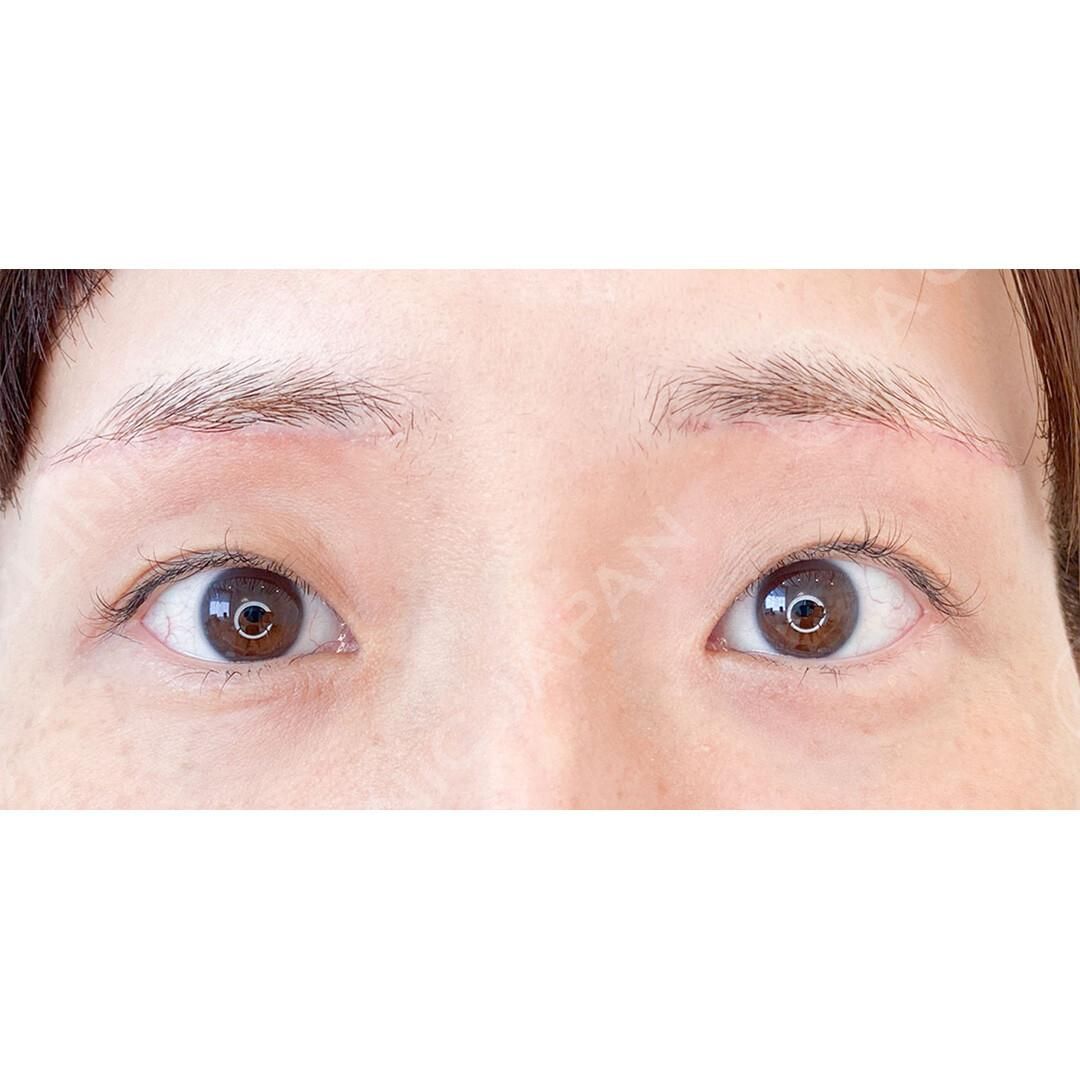 AFTER
