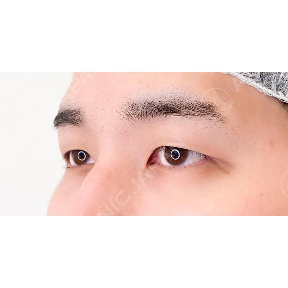 BEFORE