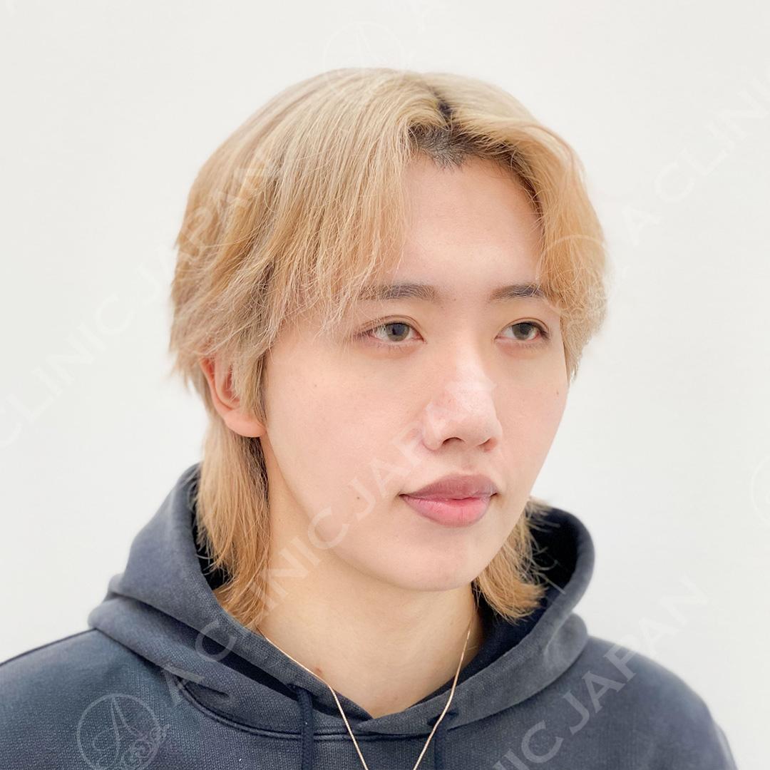 AFTER