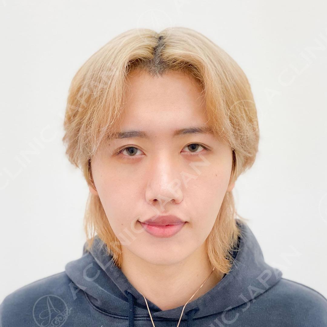 AFTER