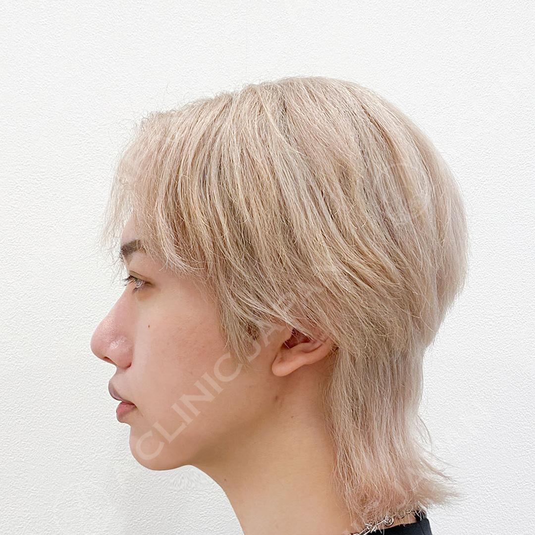 AFTER