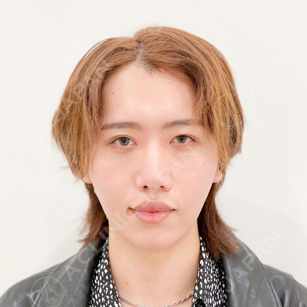 AFTER