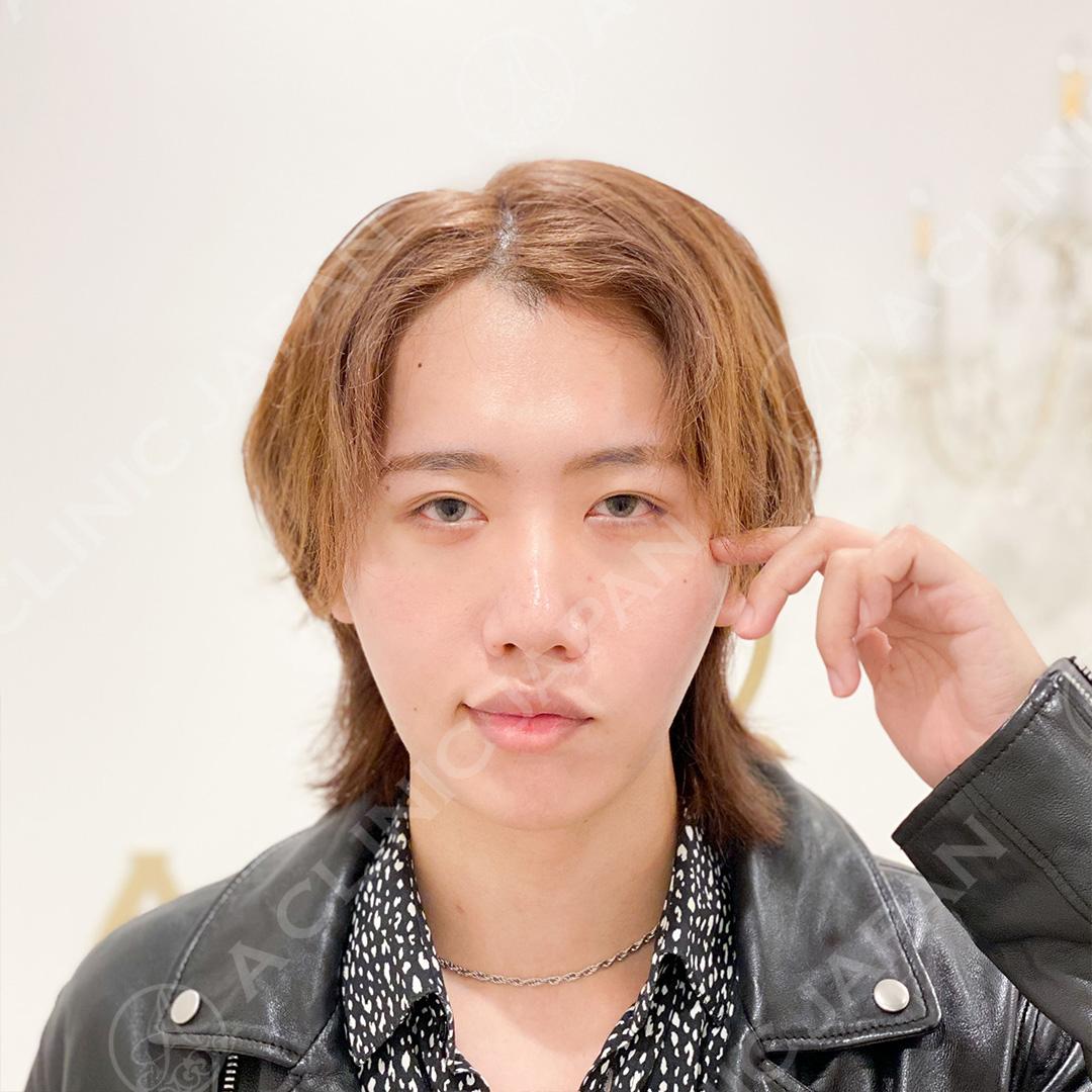 AFTER