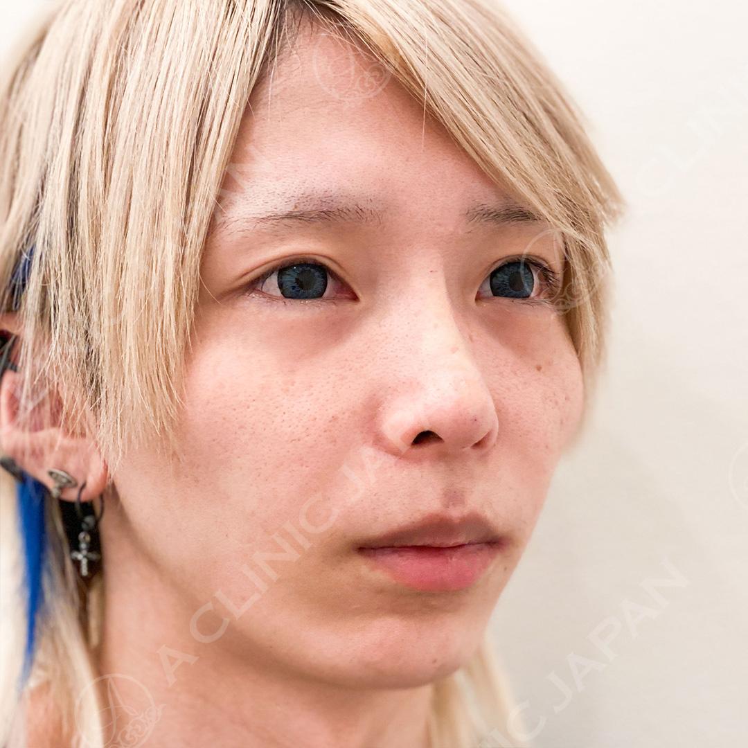 AFTER