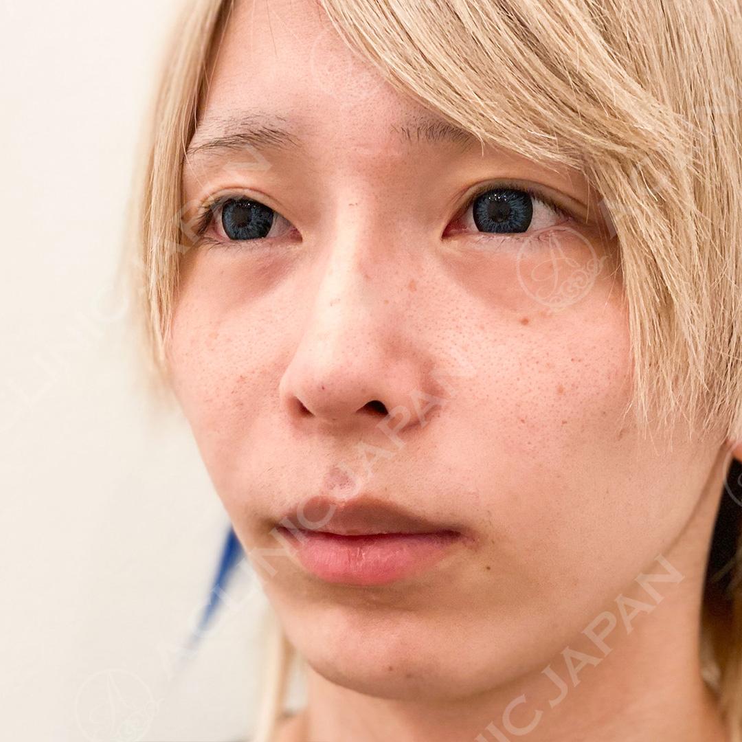 AFTER