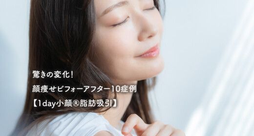 驚きの変化！顔痩せビフォーアフター10症例【1day小顔®脂肪吸引】